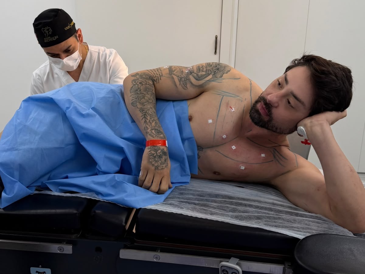 Rico Melquiades revela que seu 'toba' agora tem aroma agradável após procedimento