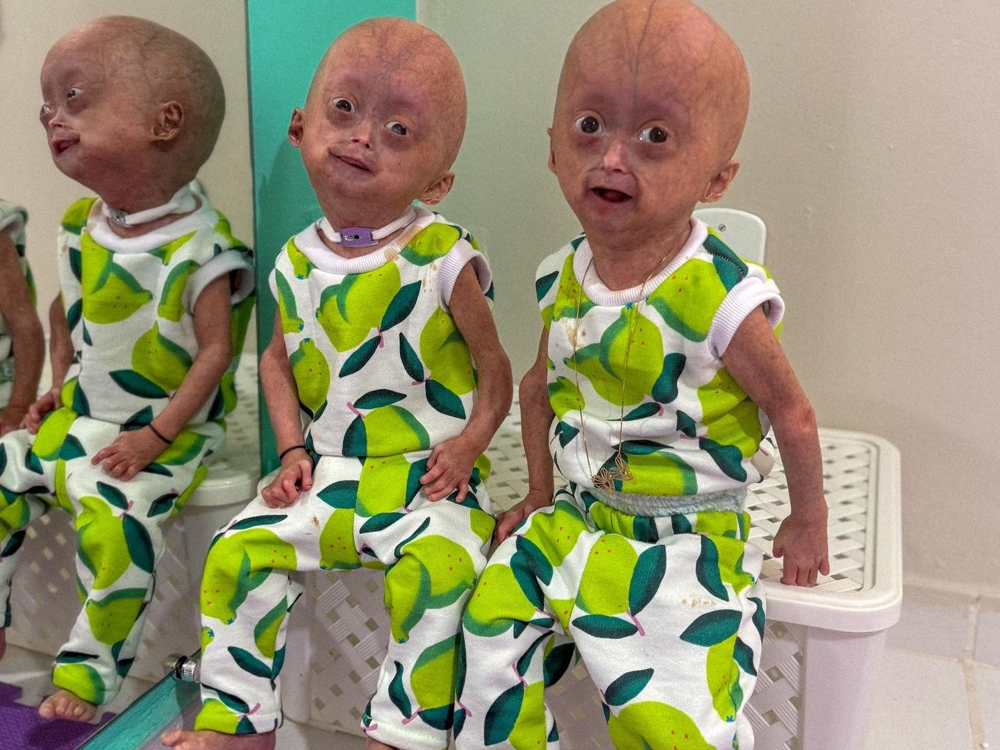 Reflexões sobre a Partida de Elis: Uma Questão de Empatia e Conscientização