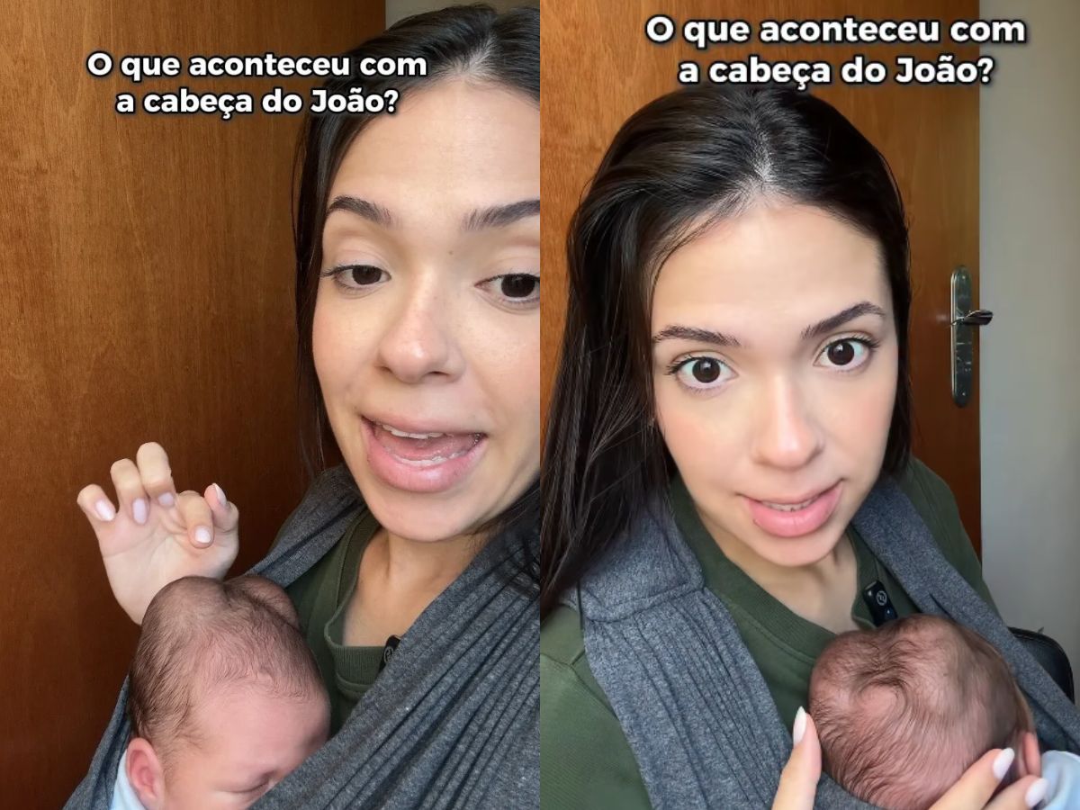 Influenciadora detalha calombos na cabeça do filho após parto difícil